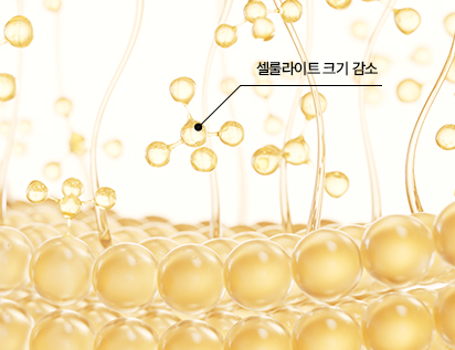 셀룰라이트 크기 감소