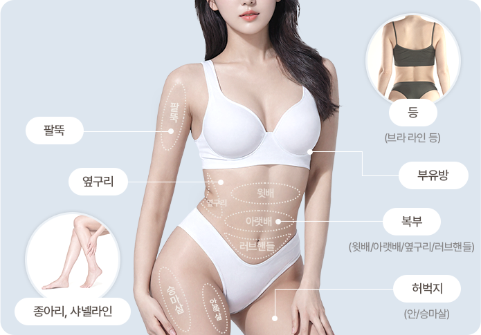 지방분해주사 바디 시술 부위