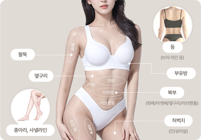반주사 바디 시술 부위