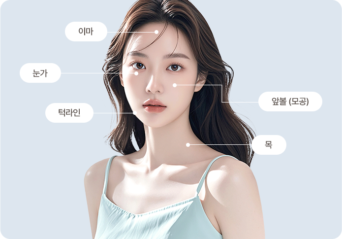 포텐자 시술부위 이미지