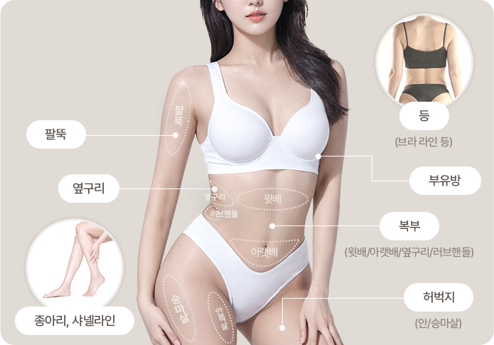 반주사 바디 시술 부위