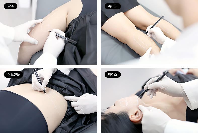 볼릿주사 트리밍주사 모바일 이미지