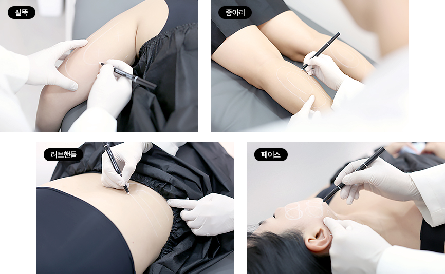 볼릿주사 트리밍주사 이미지