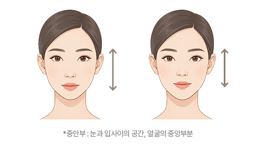힐로웨이브 중안부의 비결